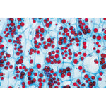 Angiospermae II. Cells and Tissues - Spanish