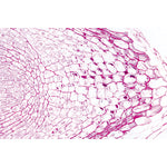 Angiospermae III. Roots - Spanish