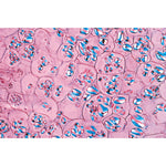 Angiospermae IV. Stems - French