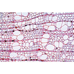 Angiospermae IV. Stems - French