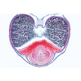 Angiospermae VII. Fruits and Seeds - French