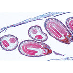 Angiospermae VII. Fruits and Seeds - Portuguese Slides 1