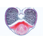 Angiospermae VII. Fruits and Seeds - Portuguese Slides 1