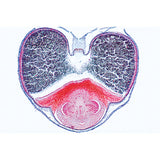 Angiospermae VII. Fruits and Seeds - Spanish