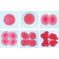 Set of Genetic Slides - Portuguese Slides