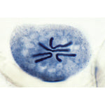 Set of Genetic Slides - Portuguese Slides