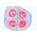 Set of Genetic Slides - Portuguese Slides