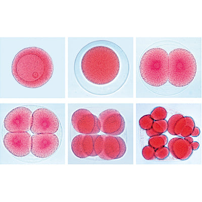 Set of Genetic Slides - German Slides