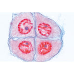 Set of Genetic Slides - German Slides