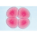 Sea Urchin Embryology (Psammenchinus miliaris) - Spanish