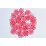 Sea Urchin Embryology (Psammenchinus miliaris) - Spanish