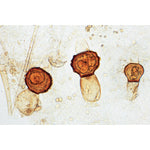 Fungi and Lichen - English Slides