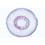 Angiospermae Roots Set- 15 Slides