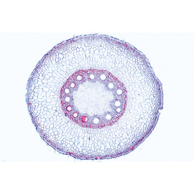 Angiospermae Roots Set- 15 Slides