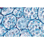 Angiospermae Roots Set- 15 Slides