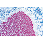 Angiospermae Roots Set- 15 Slides