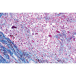 Human Pathology - French