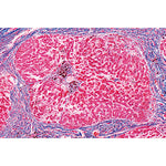 Human Pathology - Portuguese Slides