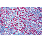 Human Pathology - Spanish