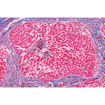 Human Pathology - German Slides