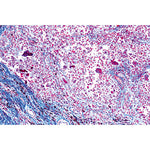 Human Pathology - German Slides