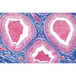 Genital System - French