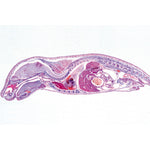 Genital System - French