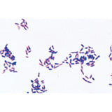 Pathogenic Bacteria - Spanish