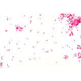 Pathogenic Bacteria - Spanish