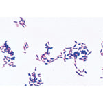 Pathogenic Bacteria - German Slides