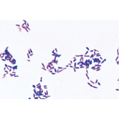 Pathogenic Bacteria - German Slides