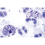 Pathogenic Bacteria - German Slides