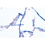 Pathogenic Bacteria - German Slides