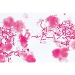 Pathogenic Bacteria - German Slides