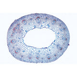 Arrangement and Types of Vascular Bundles - Spanish