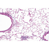Air Pollution and Allergens - French
