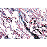 Air Pollution and Allergens - Portuguese Slides