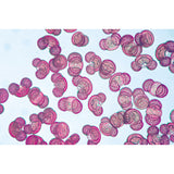 Air Pollution and Allergens - Spanish