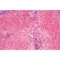 Human Pathology - English Slides