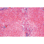 Human Pathology - English Slides