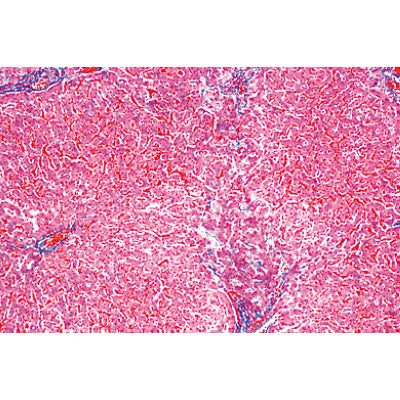 Human Pathology - English Slides