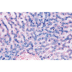 Human Pathology - English Slides