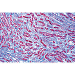 Human Pathology - English Slides