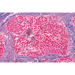 Human Pathology - English Slides