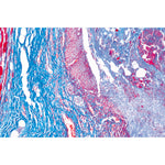 Human Pathology - English Slides