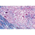 Human Pathology - English Slides