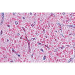 Endocrine System - English Slides