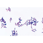 Pathogenic Bacteria - English Slides