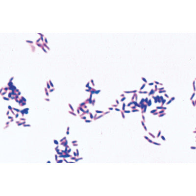 Pathogenic Bacteria - English Slides