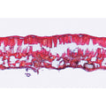 The Wood, Censequences of Pollution - English Slides